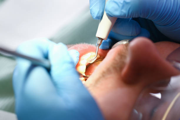 Best Cracked Tooth Emergency Dentist  in Caldwell, NJ